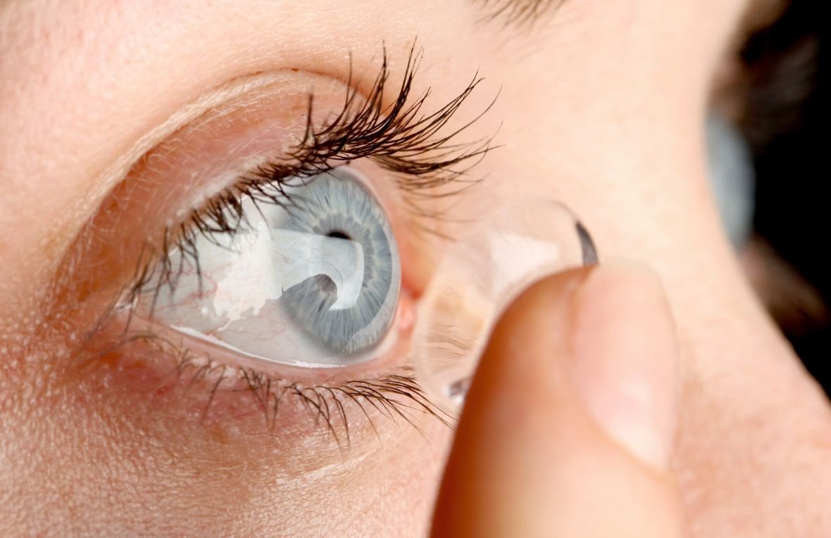 Contact Lens